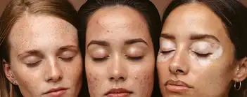 Une consultation dermato directement en pharmacie